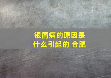 银屑病的原因是什么引起的 合肥